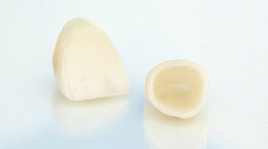 Reasons Dental Crowns Get Damaged