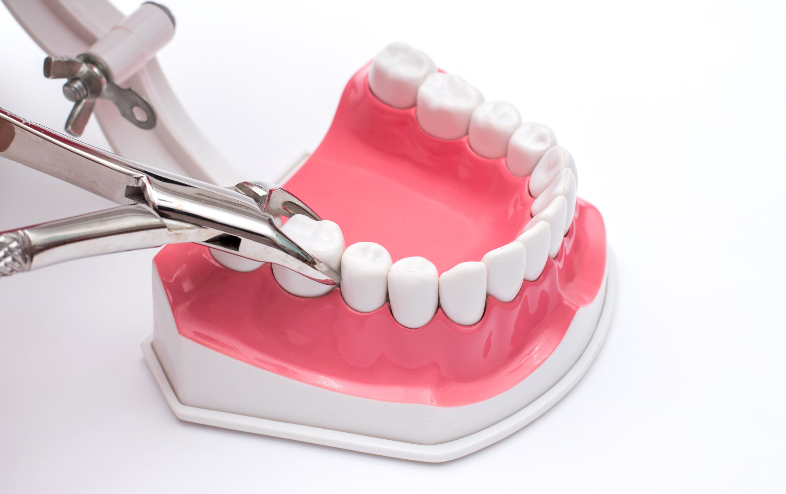 Tooth extraction at Langley